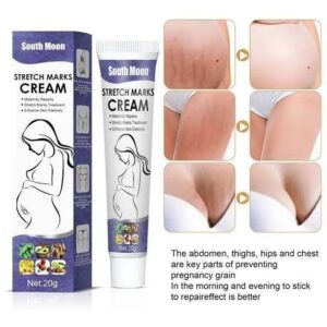 Stretch Marks Removal Cream